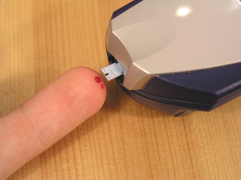 El control de cada caso durante el campamento para nios con diabetes ser personalizado. Copy